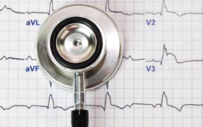 Demystifying EKGs: Understanding the Science, Applications, and Importance of Electrocardiograms