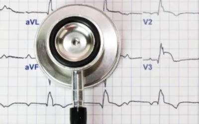 Desmitificando los Electrocardiogramas: Importancia, Aplicaciones y la Ciencia Detrás de Ellos